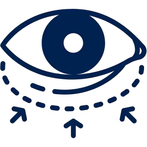 Blepharoplastik 