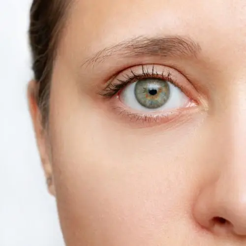 Oberlidstraffung Oberlidblepharoplastik hamburg